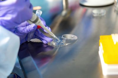 An embryologist, Oksana Lyzohub prepares reproductive cells