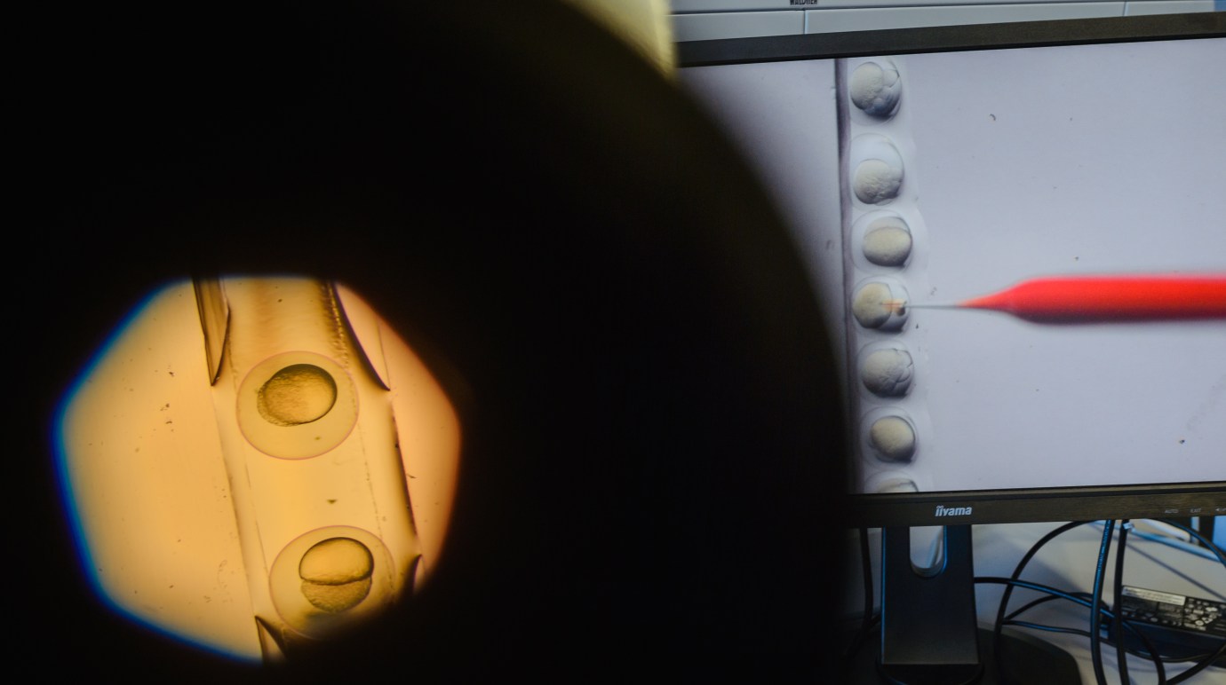 A cell and an injection needle are projected onto a screen during a CRISPR-Cas9 process at the Max Delbrueck Centre for Molecular Medicine in Berlin, Germany. (Photo by Gregor Fischer/picture alliance via Getty Images)